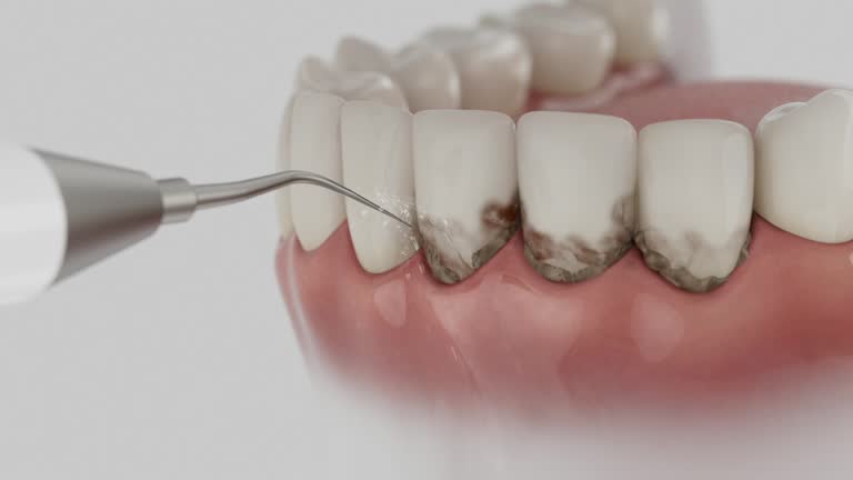 Reliable Teeth Cleaning And Checkup contractor in Stone County County, MS by Dentist Open Now